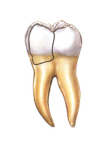 tooth1