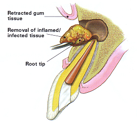 tooth-image