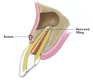 tooth-image