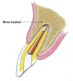 tooth-image